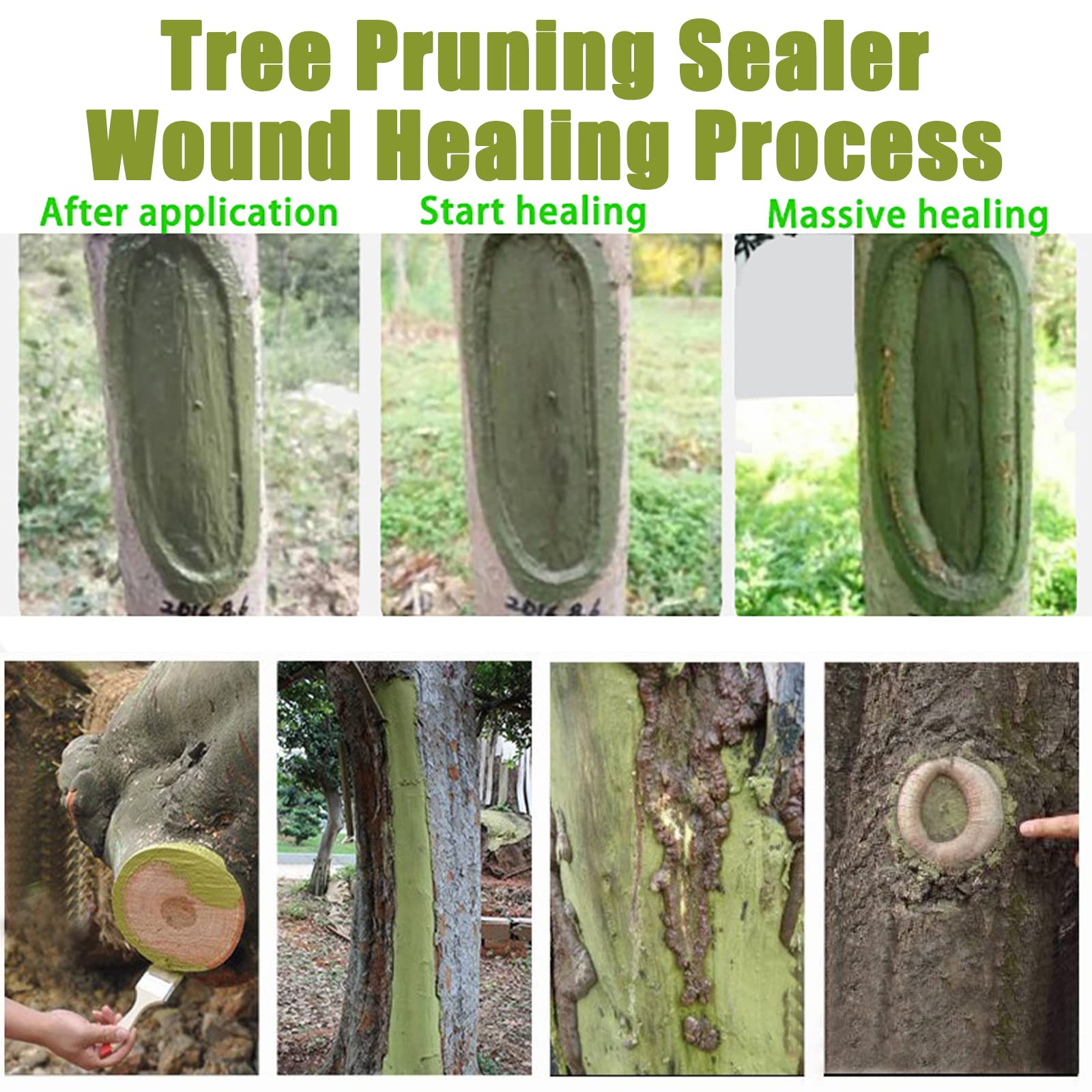Grafting with XIRUJNFD sealant for better wound protection and healing potential.