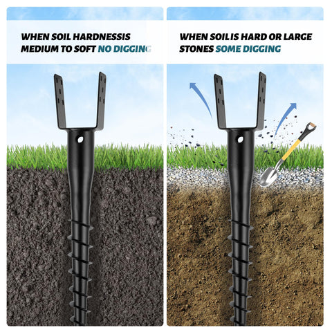 XYADX No Dig Ground Anchor hardware kit included for complete setup.
